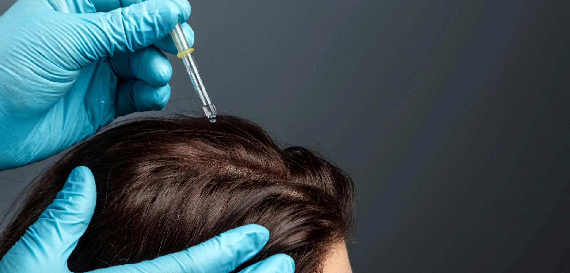 Applying scalp treatment with a dropper on hair.