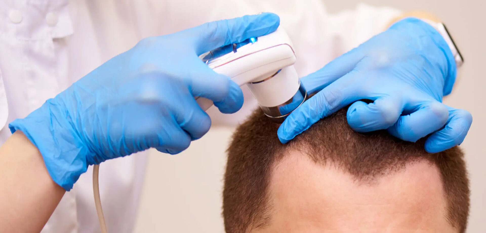 Close-up of a person receiving a scalp scan with a handheld device.