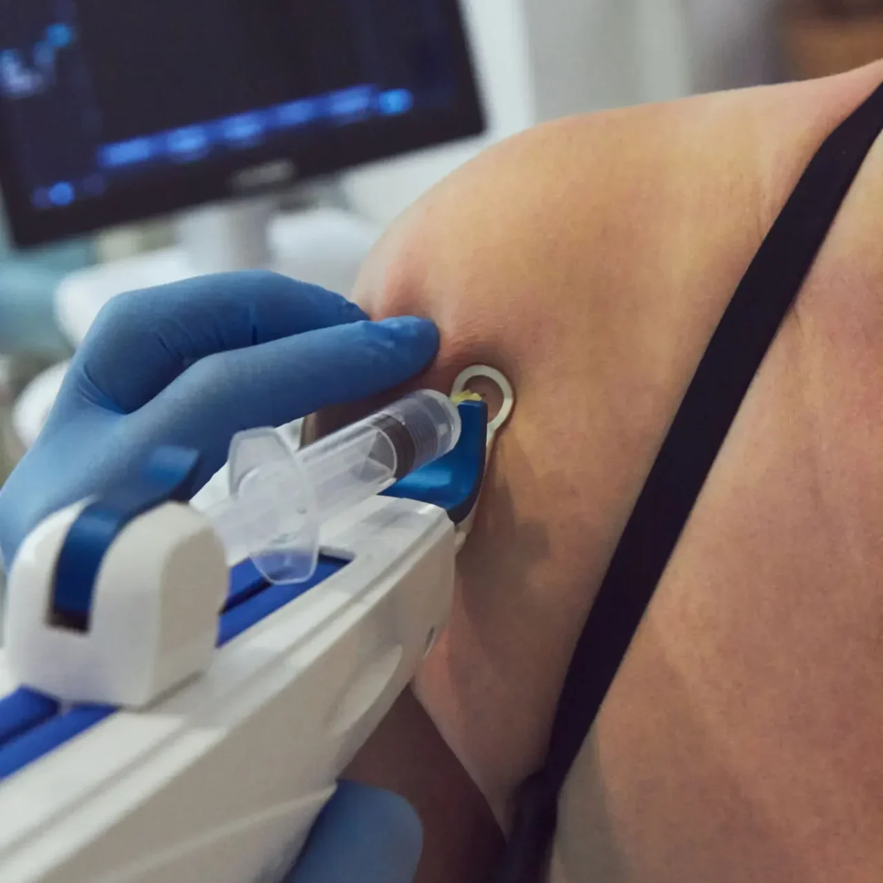 Person receiving a vaccine injection in the upper arm.